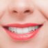 anterior-teeth